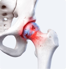 Irritated, Stiff Hip