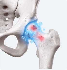 Hip Recovery in Progress
